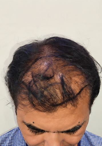 Before — Rohan V.