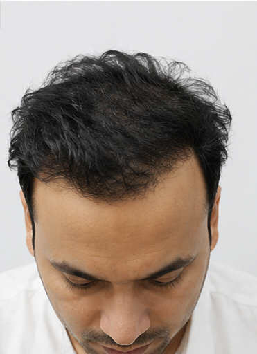 Before — Abhay G.
